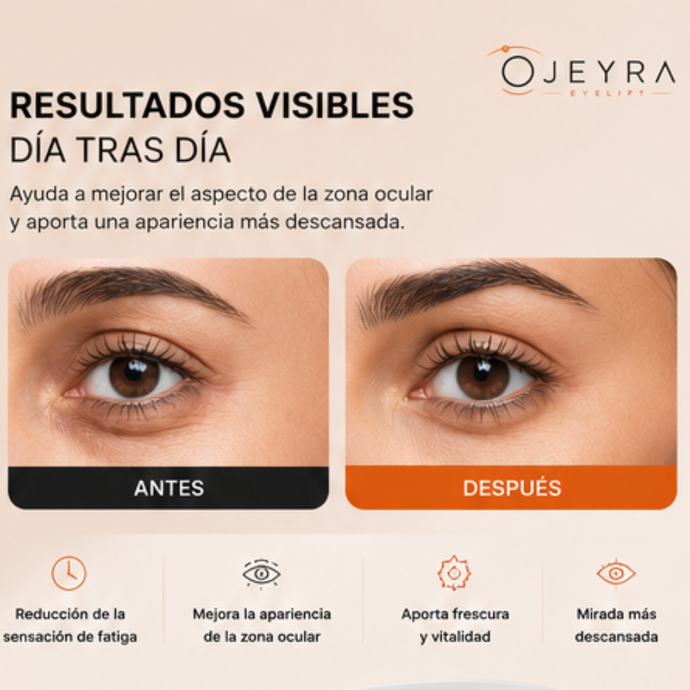 OJEYRA Eye Lift™ | Tecnología Inteligente para el Bienestar Ocular